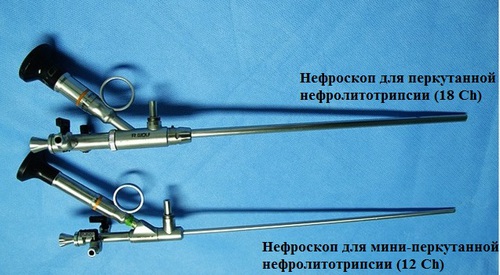 Нефроскоп для перкутанной и мини-перкутанной нефролитотрипсии
